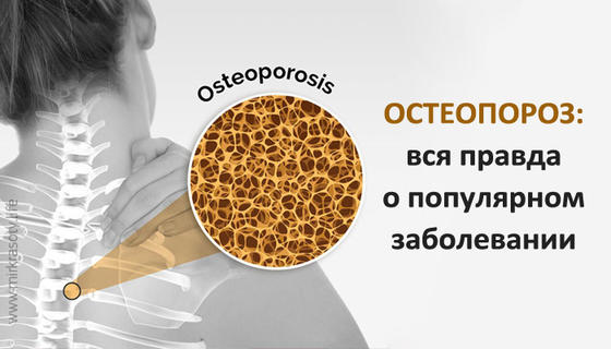 Вся правда об остеопорозе