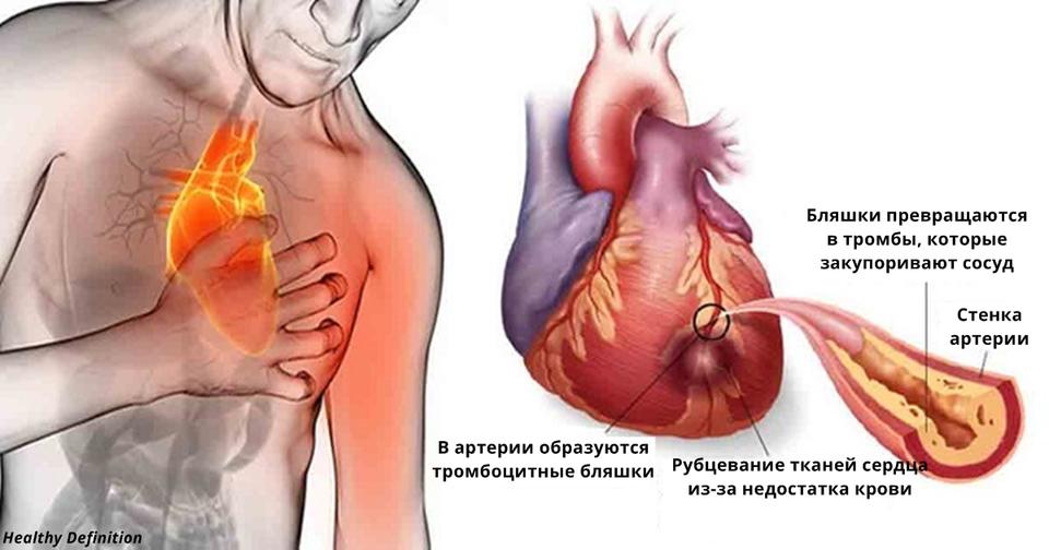 Не пейте этот напиток никогда! Если вы боитесь сердечного приступа и инсульта!