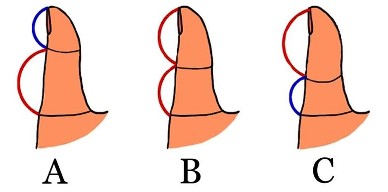 Посмотрите на свой большой палец. Какой он?