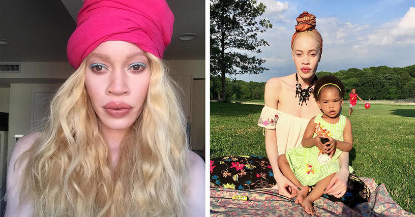 Афроамериканская модель с альбинизмом поразила всех своей необычной внешностью