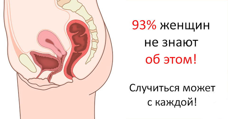 93% женщин оказались не в курсе! А ведь момент истины настанет для всех!