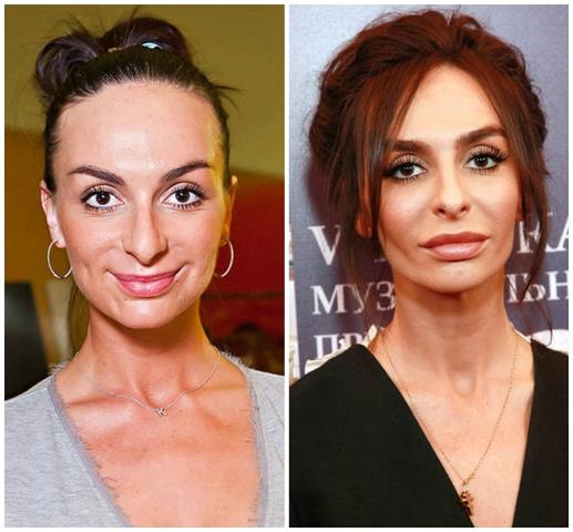 10 знаменитостей, которых не узнать на старых фото. Как по-вашему, лучше – до или после?