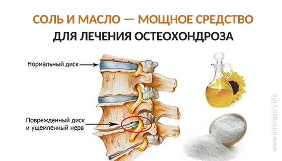 Соль и масло для лечения остеохондроза