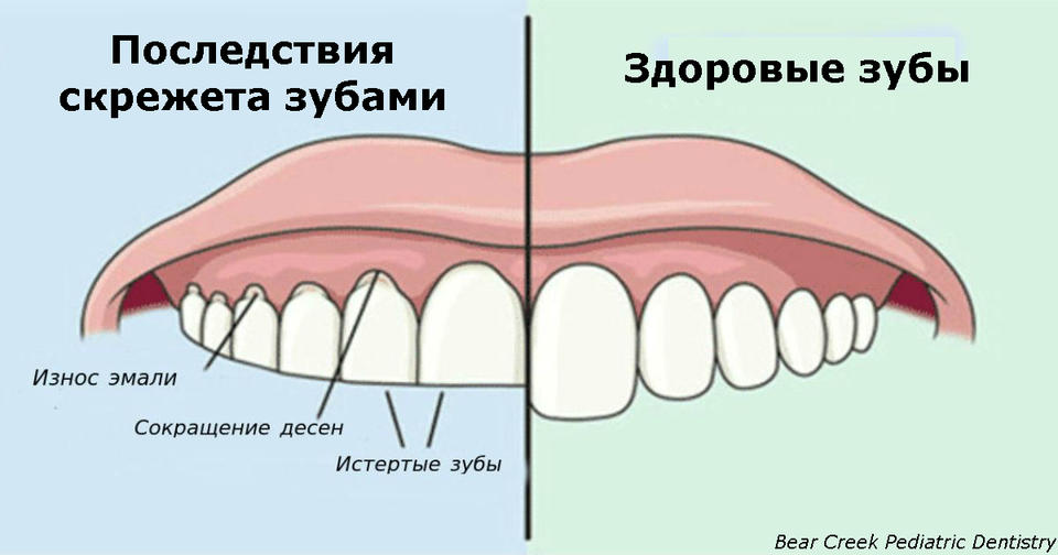  Если вы скрипите зубами по ночам, вот что это значит!