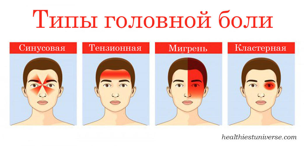 4 вида головных болей, которые сигнализируют: с организмом что то не так