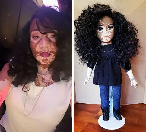 Художник создал особую серию кукол в поддержку людей с витилиго, и они выглядят просто прекрасно