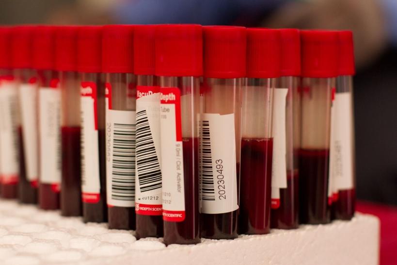Вот 11 показателей крови, которые вы обязана знать после 30