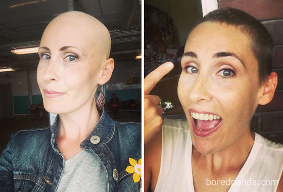 25 фото людей, которые смогли победить рак и теперь знают, что значит ″ценить жизнь″