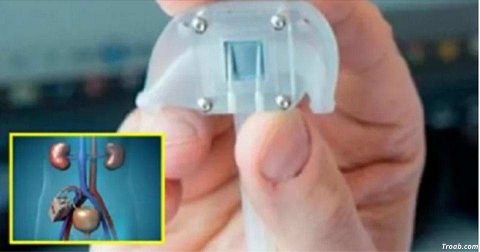 Создана первая в мире бионическая почка! Вот как она работает