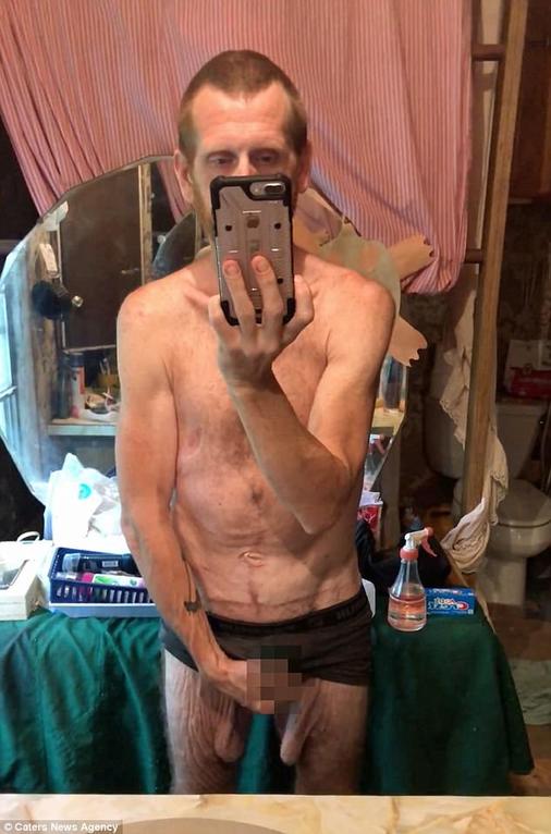 Я разъелся до 227 кг и уже даже написал завещание. Но врачи дали мне второй шанс!
