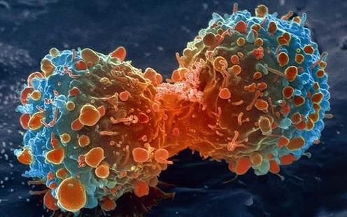 Рак - не болезнь, а дефицит кислорода в клетках! Вот как это объясняет Нобелевский лауреат 