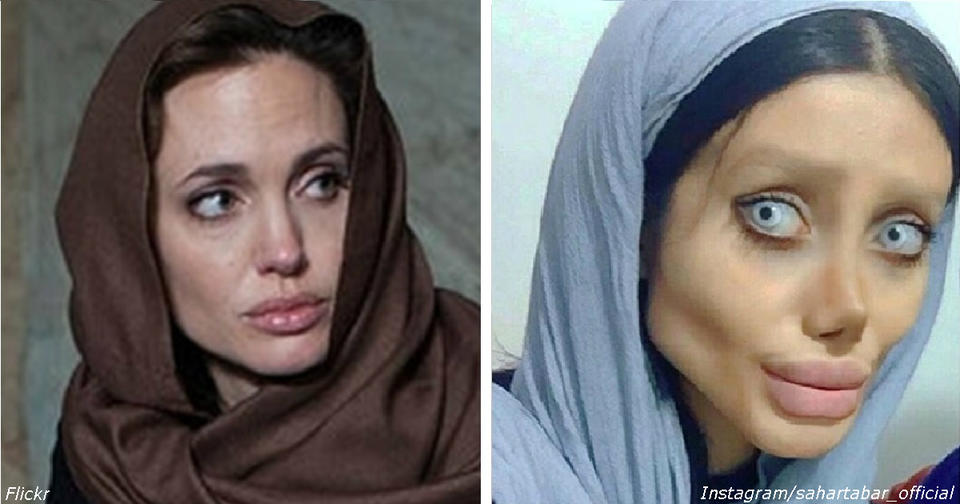 Она сделала 50 операций, чтобы стать похожей на Анджелину Джоли. Вот что получилось