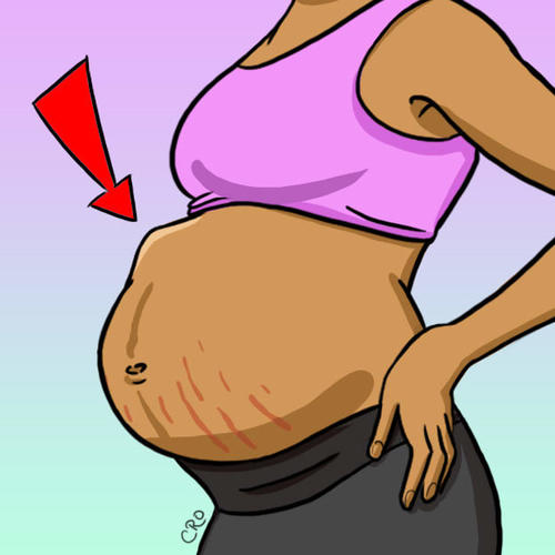 30+ ″грязных″ вещей, которые нежданчиком случаются с вами во время беременности