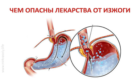 Чем вредны популярные лекарства от изжоги