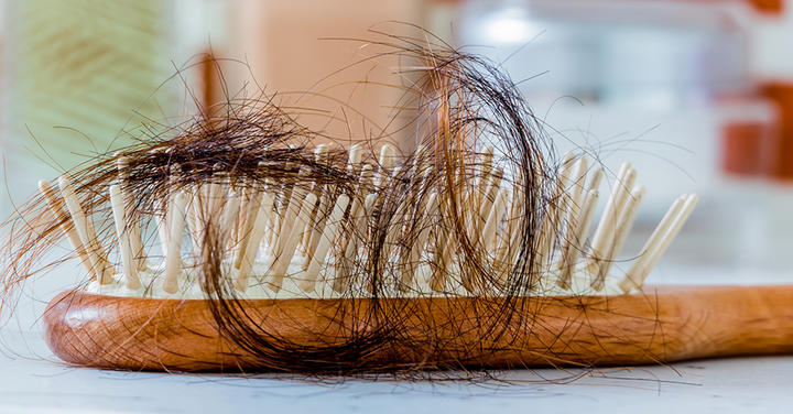 Как остановить выпадение волос: советы врача-трихолога