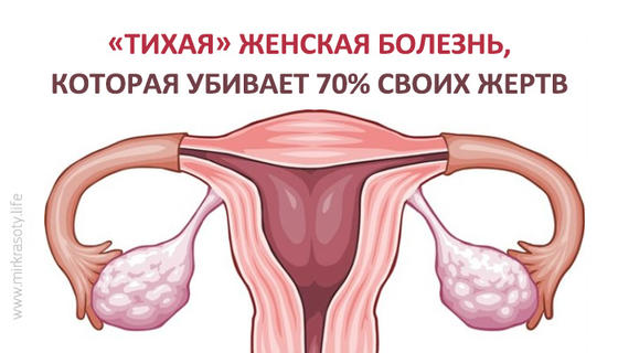 ″Тихая″ женская болезнь, которая убивает 70% своих жертв 