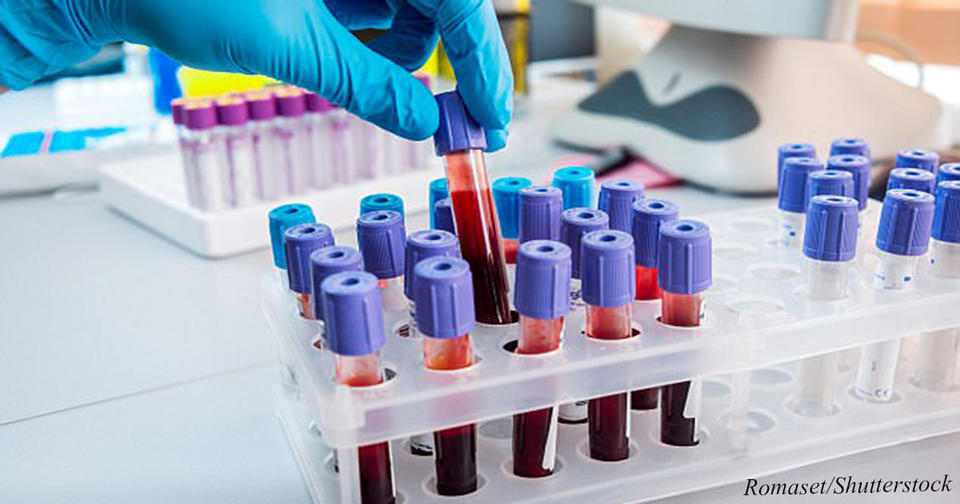 Теперь можно сдать анализ крови   и узнать про 8 видов рака, когда еще нет симптомов! 