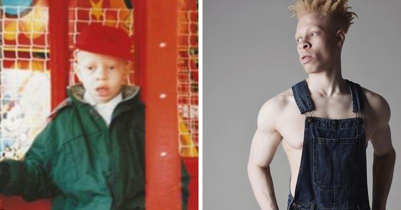 Этот парень альбинос проделал долгий путь от «гадкого утёнка» до востребованной модели. И совсем неудивительно, что он добился успеха