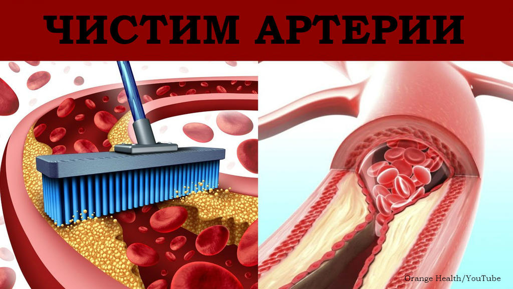 10 продуктов, которые прочистят ваши артерии без всяких лекарств