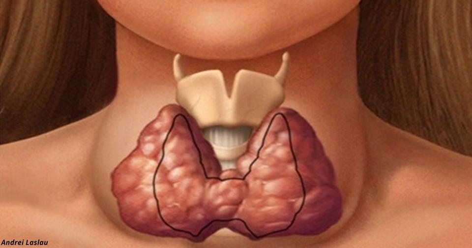 Щитовидная железа - это та, которая контролирует все тело! Вот как сохранить ее здоровье
