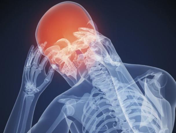 5 предупредительных сигналов: О чем говорит боль в разных частях головы?