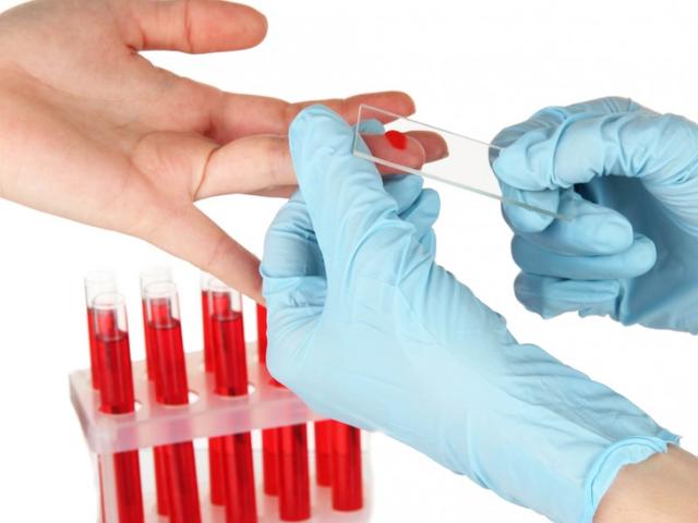 Анализ крови на ТТГ: где лучше сделать