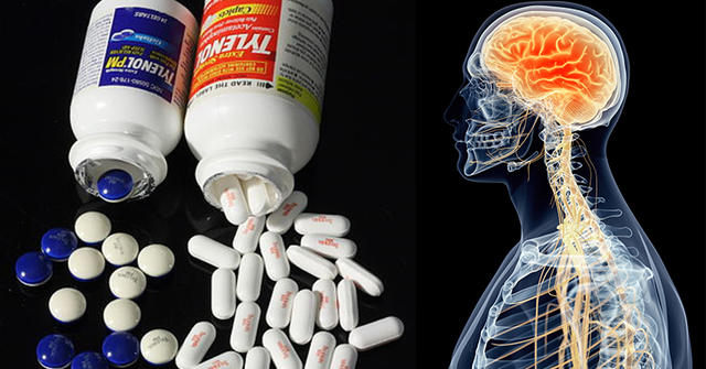 Вот 46 популярных лекарств, которые приводят к старческому слабоумию Откажитесь от них, пока не забыли!