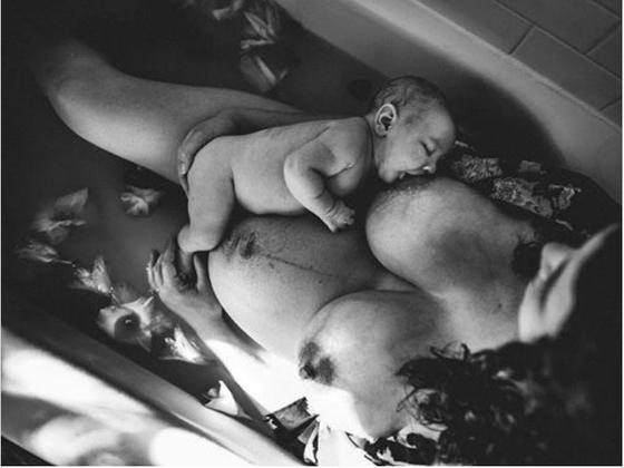 25 жестоких, но честных фото о том, как выглядит женское тело сразу после родов Правда, которую никто не показывает.