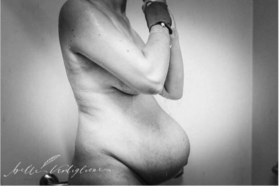 25 жестоких, но честных фото о том, как выглядит женское тело сразу после родов Правда, которую никто не показывает.
