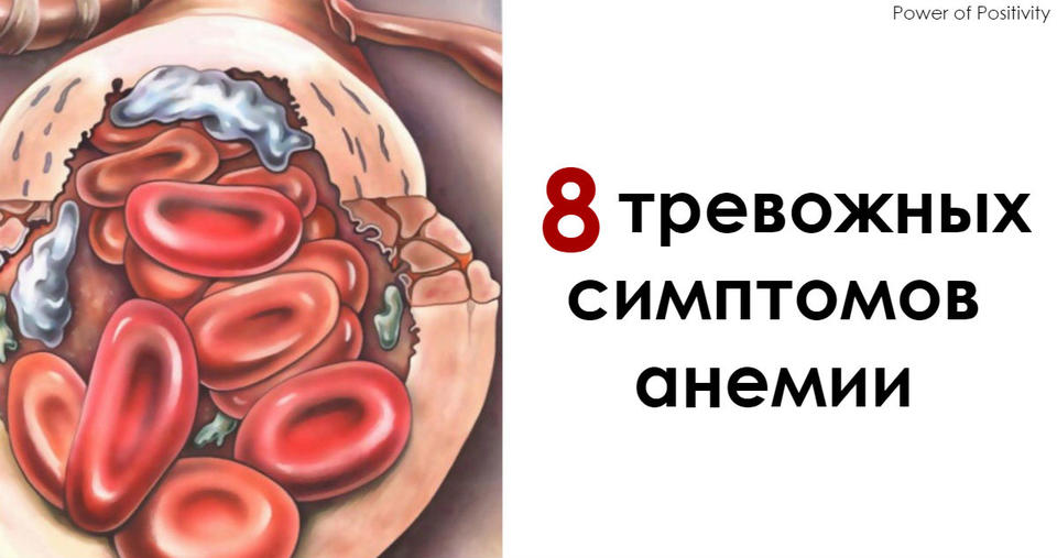 8 тревожных признаков анемии, знать о которых должен каждый Предупрежден - значит, вооружен.