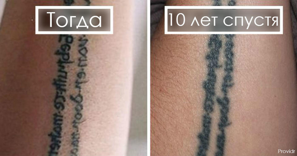Планируете сделать себе татуировку? Это 21 фото показывает, как они будут выглядеть спустя годы А потом решайте сами.