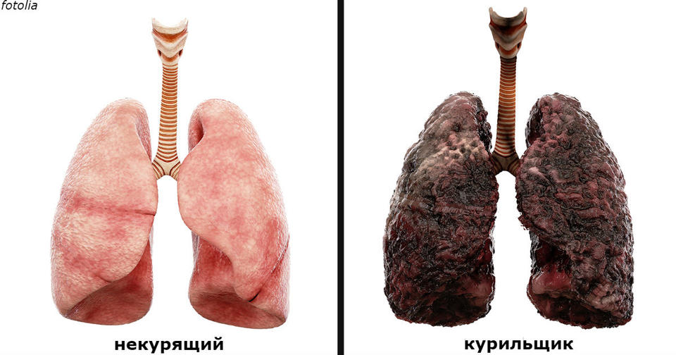 Медсестра наглядно показала, что делает курение с вашими легкими. Страшно смотреть!