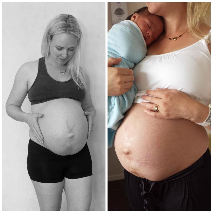 Мама и ее живот: как тело женщины в действительности выглядит после родов Честные фотографии от Джулии Босейл.