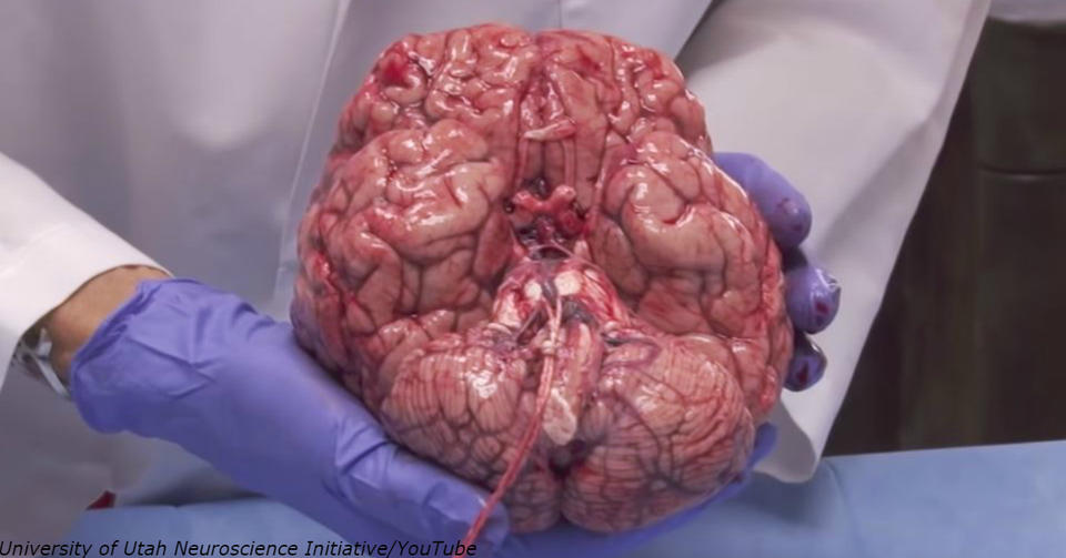 Вот реальный мозг реального человека, который пожертвовал его науке Захватывающее видео. Впечатлительным лучше не смотреть.