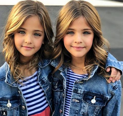 В 7 лет их назвали самыми красивыми близнецами в мире. Вот как они выглядят сейчас Они потрясающие!