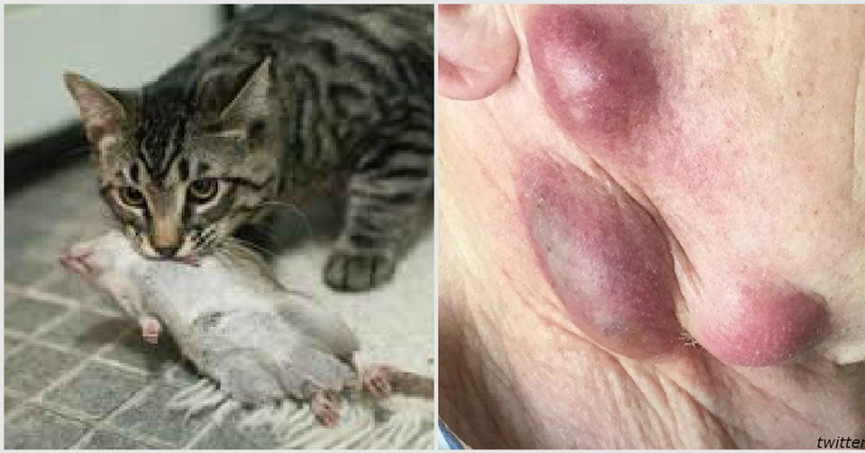 68 летний мужчина заболел опасной для жизни инфекцией. Заразился от кота! Неизвестная, но опасная.