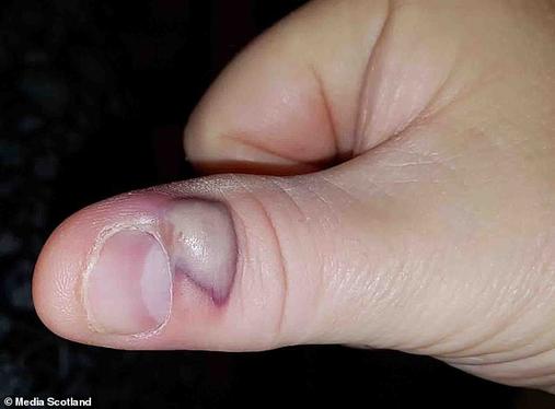 57-летний дед чуть не умер из-за того, что любил грызть ногти Ему пришлось серьезно сражаться за свою жизнь!