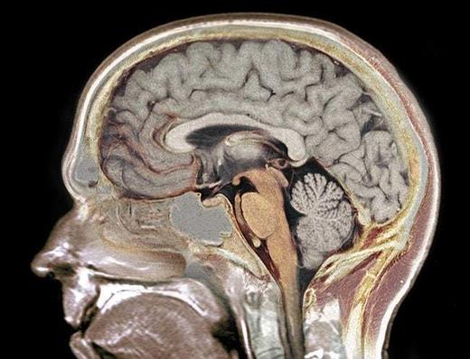 12 жутких, но захватывающих фактов о мозге, которых вы точно никогда не слышали Страшно интересно.