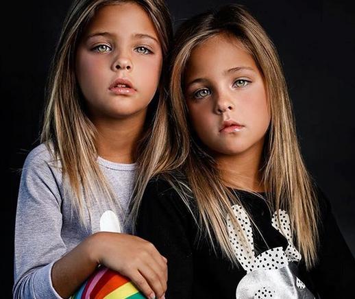 В 7 лет их назвали самыми красивыми близнецами в мире. Вот как они выглядят сейчас Они потрясающие!