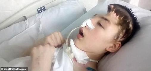 16-летний Ваня Крапивин, спасший мать от насильника, сражался за жизнь 19 месяцев Вот чем все закончилось.