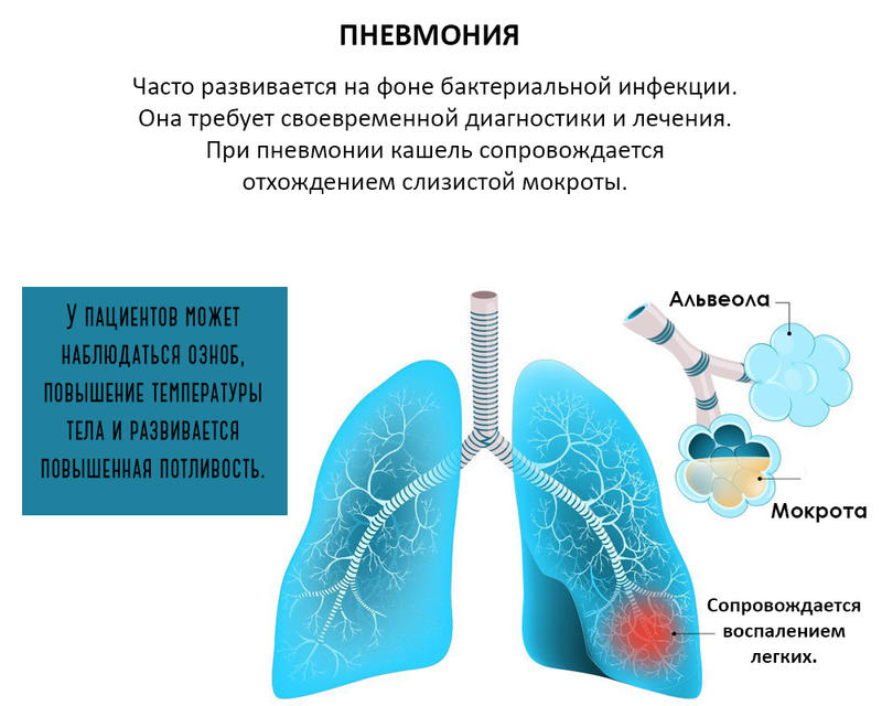 Как отличить друг от друга трахеит, бронхит и пневмонию?