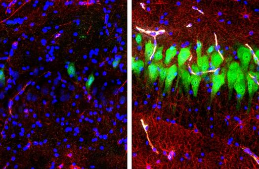 Нейробиологи вернули к жизни клетки «мёртвого» мозга свиньи! Это как вообще?