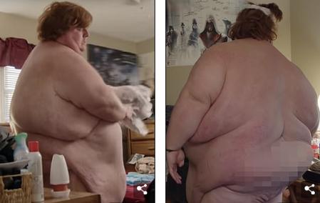 34-летний парень весит 317 кило, сутками играет в игры и не хочет ничего менять