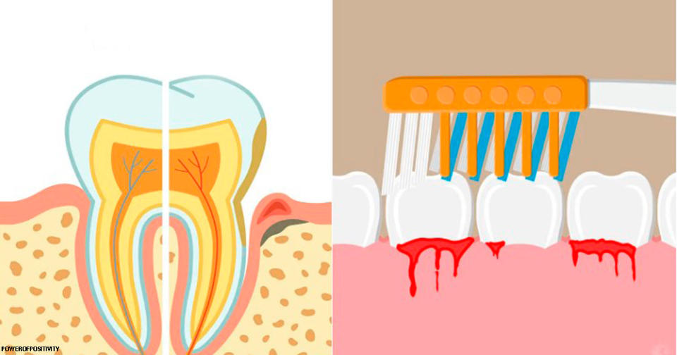 Стоматологи дали 10 советов о том, что делать, если у вас кровоточат десны