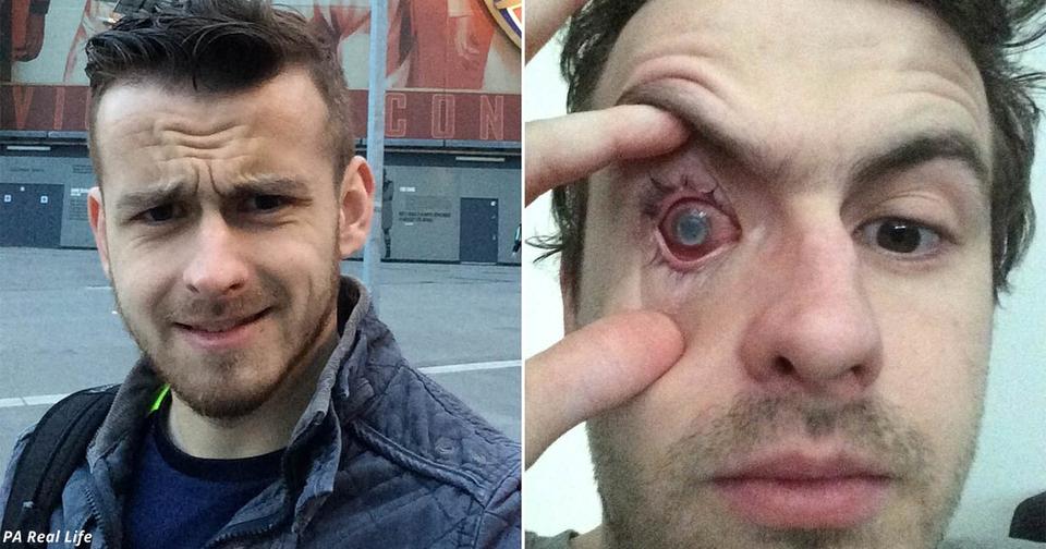 Мужчина ослеп на один глаз после того, как принял душ в контактных линзах