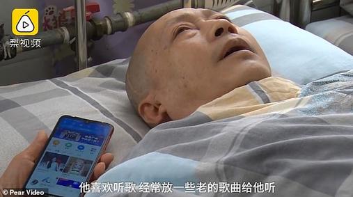 Китаец проснулся после 5-летней комы: жена ухаживала за ним по 20 часов в день