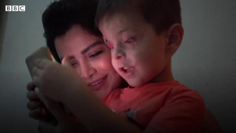 Лицо мальчика, которое отражает всю трагедию и ужас войны в Сирии