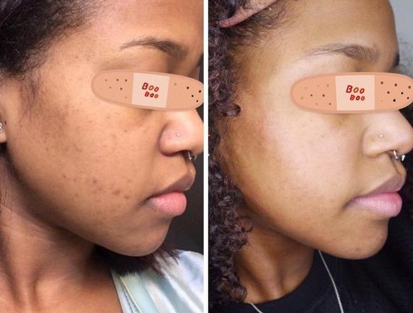 Секреты от девушек, которым удалось сделать кожу своего лица совершенной: всего несколько минут в день - и проблем как не бывало