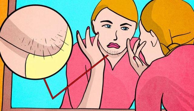 Знакомый врач рассказал, почему у некоторых женщин есть волосы на подбородке: 7 причин, которые нельзя игнорировать