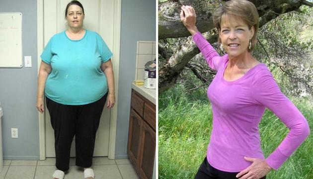 63-летняя женщина, весившая более 160 кг, смогла сбросить 102 кг: фото результата и советы